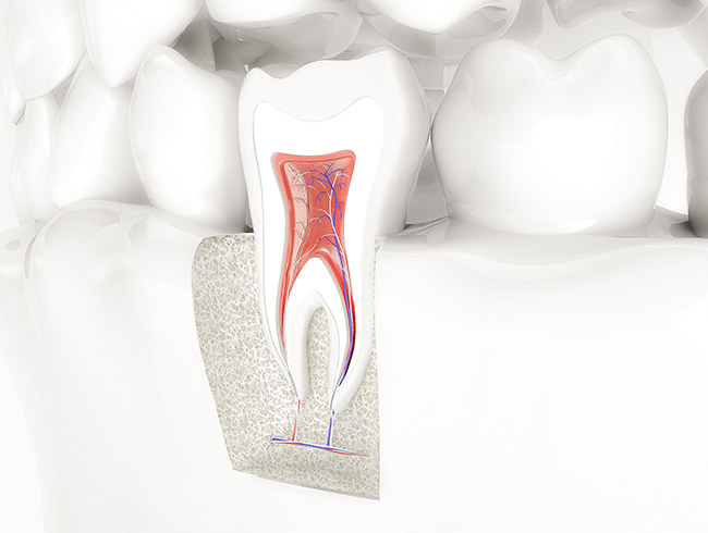 Endodontie - Wurzelkanal Behandlung - Zahnarzt in 58300 Wetter (Ruhr)